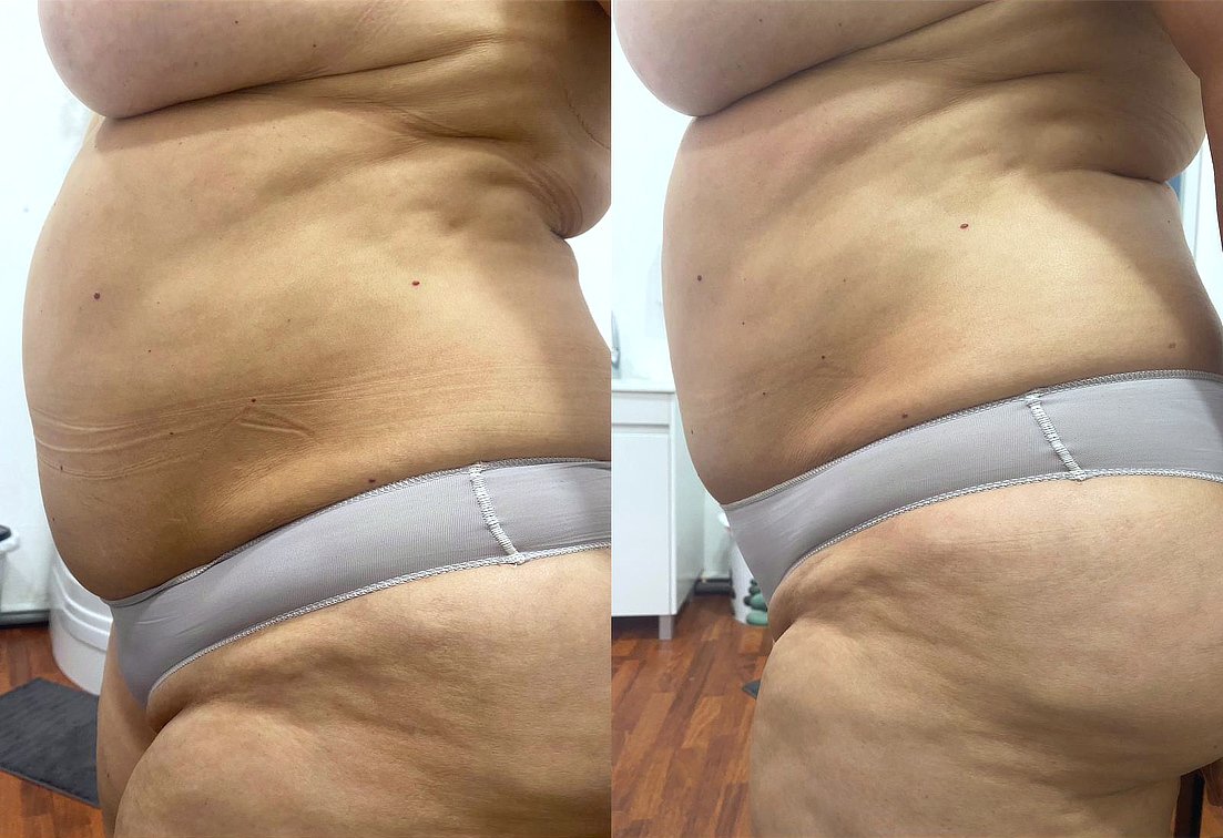 Barriga-2 Barriga-2