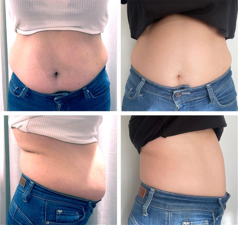 Barriga Barriga